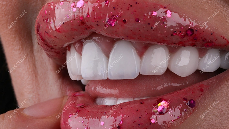 Gums after treatment